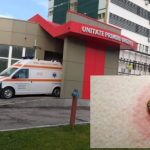 Atenzionare in Olt Mai multe persoane au fost spitalizate din cauza muscaturilor de capuse Sfaturile medicilor