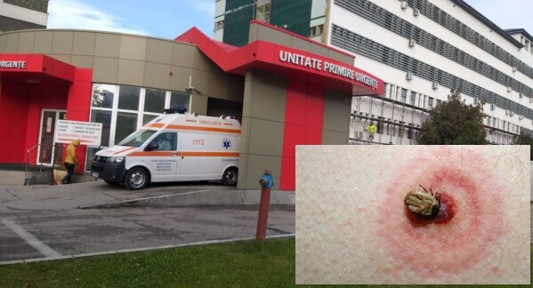 Avertizare in jude tul Olt zeci de persoane intepate de capuse de la inceputul anului